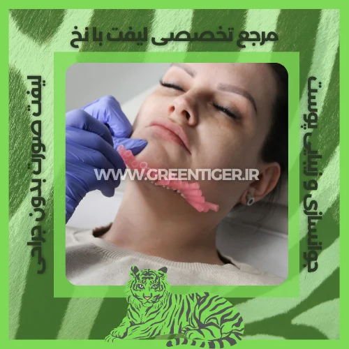 کاشت نخ جوانسازی صورت