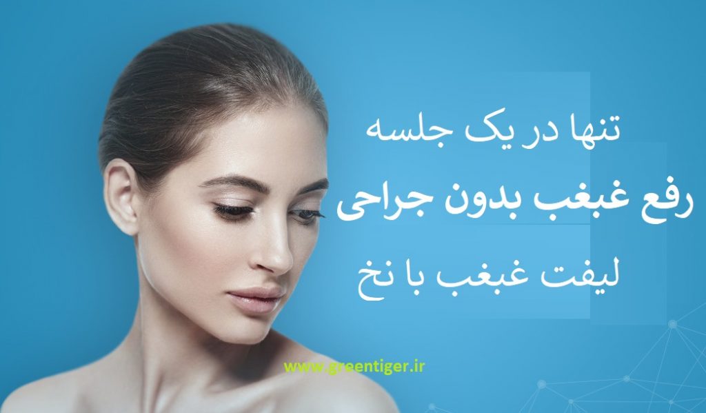 لیفت غبغب با نخ نی نی سایت