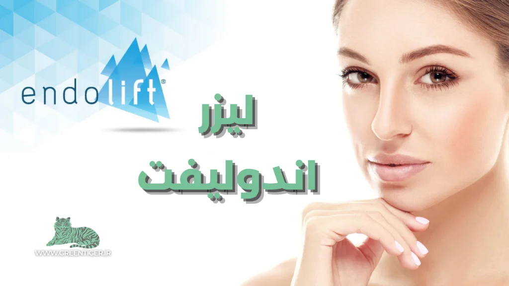 لیزر اندولیفت چیه