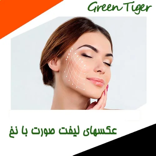 عکسهای لیفت صورت با نخ